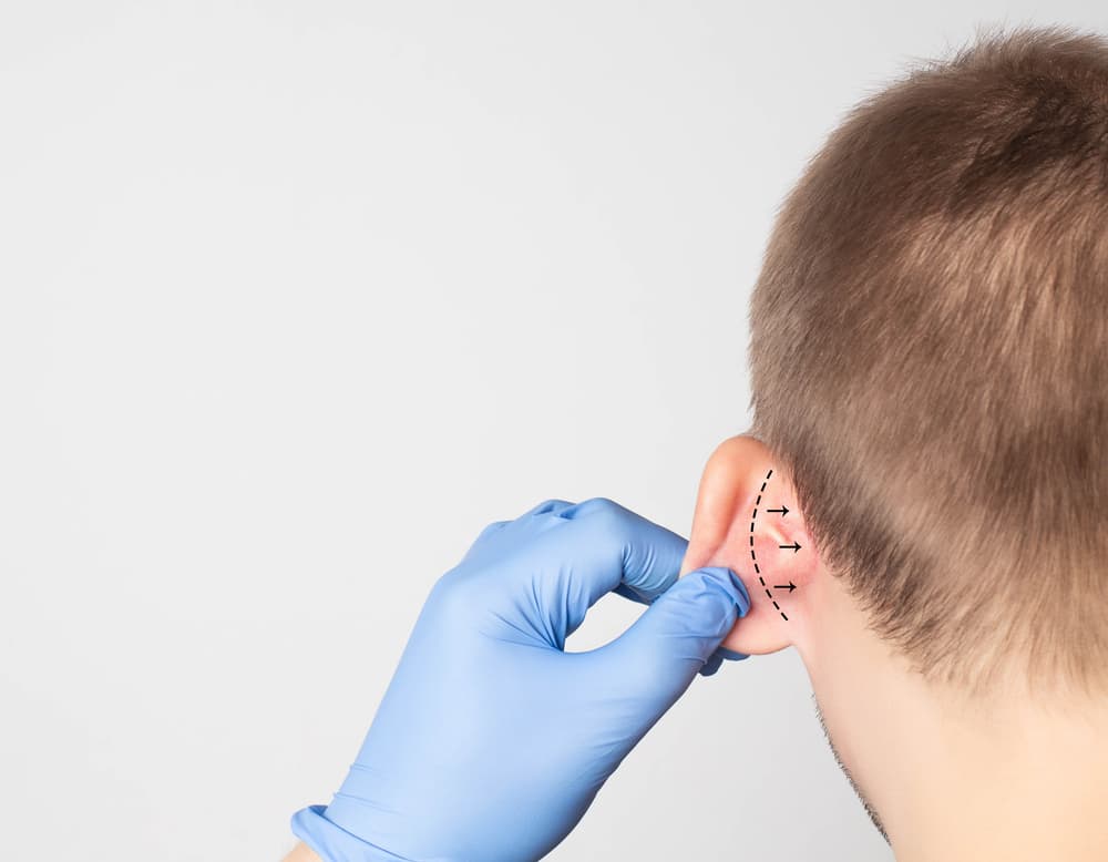 ניתוחים פלסטיים באוזניים