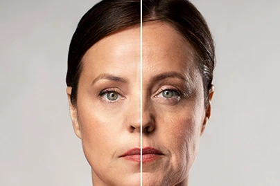 ניתוח מתיחת פנים